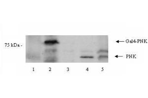 Western blot using  Affinity Purified anti-PNK antibody shows detection of a 57 kDa band corresponding to human PNK in a Y190 yeast cell lysate (lane 1), Y190 yeast cell lysate + human PNK (Gal DNA BP) (lane 2), EM9 XH Chinese hamster ovary cell lysate (lane 3), EM9 XH Chinese hamster ovary cell lysate + human PNK (lane 4) and a HeLa cell lysate (lane 5). (PNKP anticorps  (Internal Region))