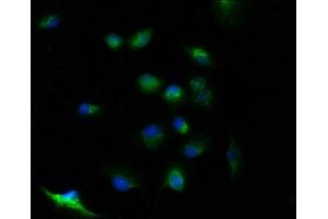 Immunofluorescence staining of U251 cells with ABIN7174397 at 1:100, counter-stained with DAPI.