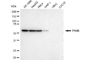 Western blotting analysis using P4HB antibody (ABIN7799919). (P4HB anticorps)