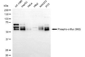 Western blotting analysis using phospho-c-Myc (S62) antibody (ABIN7799503).