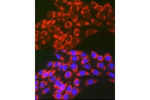 Immunofluorescence analysis of NIH-3T3 cells using TFEB Rabbit pAb (ABIN6128819, ABIN6149043, ABIN6149045 and ABIN6223149) at dilution of 1:100 (40x lens). (TFEB anticorps)