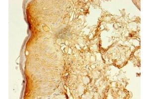 Immunohistochemistry of paraffin-embedded human skin tissue using ABIN7158219 at dilution of 1:100 (LSMEM2 anticorps  (AA 1-96))