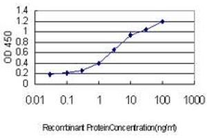Detection limit for recombinant GST tagged TOPORS is approximately 0.