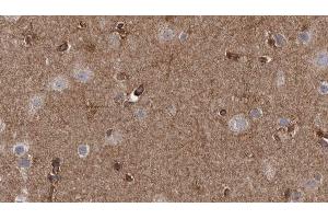 ABIN6272633 at 1/100 staining Human brain cancer tissue by IHC-P. (GABARAPL2 anticorps  (N-Term))