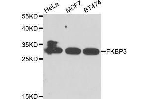 Western blot analysis of extracts of various cell lines, using FKBP3 antibody (ABIN5974155) at 1/1000 dilution.