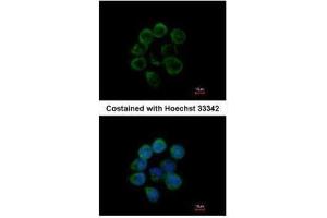 ICC/IF Image Immunofluorescence analysis of methanol-fixed A431, using Albumin, antibody at 1:200 dilution.