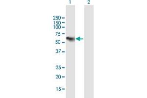 Western Blot analysis of C1RL expression in transfected 293T cell line by C1RL MaxPab polyclonal antibody. (C1RL anticorps  (AA 1-487))