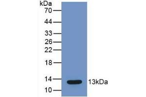 Detection of Recombinant MCP1, Mouse using Monoclonal Antibody to Monocyte Chemotactic Protein 1 (MCP1)
