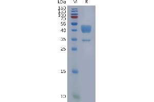 Human C5AR1 Protein, hFc Tag on SDS-PAGE under reducing condition.