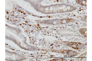 Immunoperoxidase of monoclonal antibody to CDH18 on formalin-fixed paraffin-embedded human small Intestine. (CDH18 anticorps  (AA 467-576))