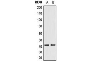 Western blot analysis of KCNK15 expression in JEG3 (A), HeLa (B) whole cell lysates. (KCNK15 anticorps  (C-Term))