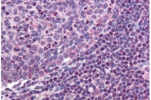 Colon, lymphoid follicle (MALT1 anticorps  (AA 43-57))