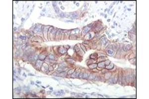 Immunohistochemistry (IHC) image for anti-Insulin-Like Growth Factor 1 Receptor (IGF1R) (truncated) antibody (ABIN2464067)