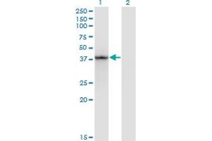 Western Blot analysis of STAT5B expression in transfected 293T cell line by STAT5B monoclonal antibody (M01), clone 1A1.