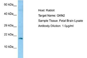 Western Blotting (WB) image for anti-Gastrokine 2 (GKN2) (N-Term) antibody (ABIN2790149)