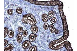 IHC-P Image Cytokeratin 6 antibody detects Cytokeratin 6 protein at membrane on mouse cervix by immunohistochemical analysis.