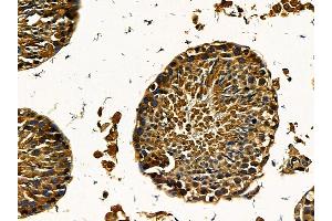ABIN7095560 and ABIN7099617 at 1/100 staining mouse testis tissue by IHC-P.