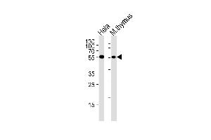 Chk1 Antibody  (ABIN388983 and ABIN2839219) western blot analysis in Hela cell line and mouse thymus tissue lysates (35 μg/lane). (CHEK1 anticorps  (AA 258-287))