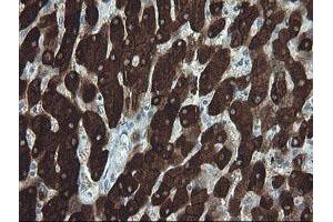 Immunohistochemistry (IHC) image for anti-Formiminotransferase Cyclodeaminase (FTCD) antibody (ABIN1496377)