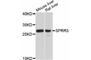 Western blot analysis of extracts of various cell lines, using SPRR3 antibody. (SPRR3 anticorps)