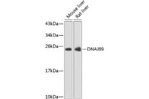 Western blot analysis of extracts of various cell lines, using DN antibody (ABIN6127771, ABIN6139715, ABIN6139716 and ABIN6223392) at 1:1000 dilution. (DNAJB9 anticorps  (AA 24-223))