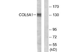 Immunohistochemistry analysis of paraffin-embedded human heart tissue using Collagen V α1 antibody. (COL5A1 anticorps)