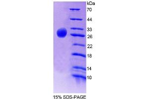 SDS-PAGE analysis of Human FLRT2 Protein.
