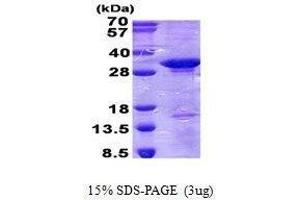 Figure annotation denotes ug of protein loaded and % gel used. (CD300c Protein (CD300C))