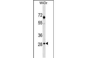 Western blot analysis in WiDr cell line lysates (35ug/lane). (SNX11 anticorps  (AA 75-104))