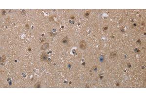 Immunohistochemistry of paraffin-embedded Human brain tissue using MGLL Polyclonal Antibody at dilution 1:40 (MGLL anticorps)
