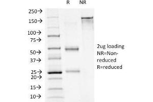SDS-PAGE Analysis Purified FOXA1 Monoclonal Antibody (FOXA1/1241). (FOXA1 anticorps  (AA 372-472))