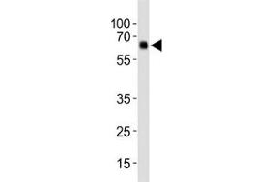 Western blot analysis of lysate from human placenta tissue, using Park6/ PINK1 antibody diluted at 1:1000.