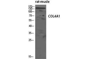 Western Blot (WB) analysis of specific cells using COL4A1 Polyclonal Antibody. (COL4A1 anticorps  (N-Term))