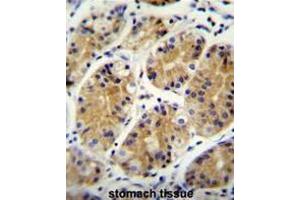 MGC24975 Antibody (C-term) immunohistochemistry analysis in formalin fixed and paraffin embedded human stomach tissue followed by peroxidase conjugation of the secondary antibody and DAB staining. (PRR22 anticorps  (C-Term))