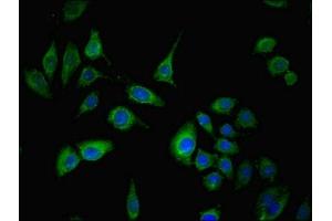 Immunofluorescent analysis of A549 cells using ABIN7170610 at dilution of 1:100 and Alexa Fluor 488-congugated AffiniPure Goat Anti-Rabbit IgG(H+L) (SPIN4 anticorps  (AA 1-249))