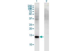 Western Blot analysis of RBP7 expression in transfected 293T cell line by RBP7 monoclonal antibody (M01), clone 4F4.