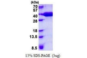 Figure annotation denotes ug of protein loaded and % gel used. (VBP1 Protéine)