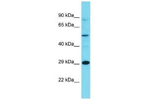 Western Blotting (WB) image for anti-Olfactory Receptor, Family 7, Subfamily E, Member 86 Pseudogene (OR7E86P) (C-Term) antibody (ABIN2791455) (OR7E86P anticorps  (C-Term))