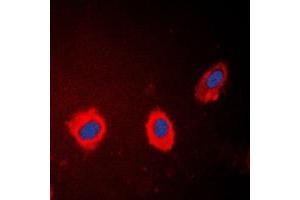Immunofluorescent analysis of Cytokeratin 17 staining in HeLa cells. (KRT17 anticorps  (C-Term))