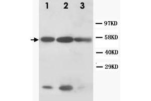 Western Blot analysis of KRT8 expression from cell extracts with KRT8 polyclonal antibody . (KRT8 anticorps  (N-Term))