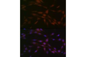 Immunofluorescence analysis of NIH-3T3 cells using Casein Kinase 2 beta (CSNK2B) (CSNK2B) Rabbit mAb (ABIN1680593, ABIN3019007, ABIN3019008 and ABIN7101698) at dilution of 1:100 (40x lens).