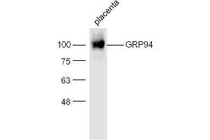 Mouse placenta lysates probed with Rabbit Anti-GRP94 Polyclonal Antibody, Unconjugated  at 1:500 for 90 min at 37˚C (GRP94 anticorps  (AA 554-650))