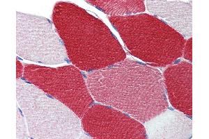 Anti-MYL6 antibody IHC of human skeletal muscle.