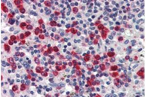 Human Spleen (formalin-fixed, paraffin-embedded) stained with LCN2 antibody ABIN337222 at 2. (Lipocalin 2 anticorps  (AA 60-72))