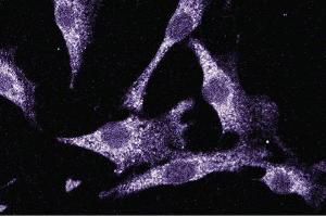 Immunofluorescent staining of NIH-3T3 cells. (LIM Domain Kinase 1 anticorps  (AA 232-333))