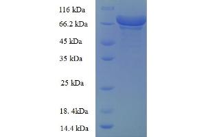SDS-PAGE (SDS) image for Glucose-6-Phosphate Dehydrogenase (G6PD) (AA 1-486), (partial) protein (GST tag) (ABIN5713166)