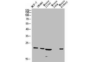 Western blot analysis of Jurkat U937 Raji mouse-eye lysate, antibody was diluted at 1000. (CGRP anticorps  (AA 80-141))