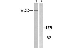 Western Blotting (WB) image for anti-Ubiquitin Protein Ligase E3 Component N-Recognin 5 (UBR5) (N-Term) antibody (ABIN1848820)
