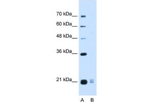 Western Blotting (WB) image for anti-Placenta-Specific 1-Like (PLAC1L) antibody (ABIN2463114) (PLAC1L anticorps)