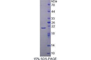 SDS-PAGE of Protein Standard from the Kit  (Highly purified E.